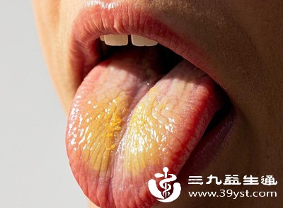 当舌体肥厚逐渐加重,或后期出现不适时,可能已导致病情加重,增加调理难度 当舌体肥厚逐渐加重,或后期出现不适时,可能已导致病情加重,增加调理难度