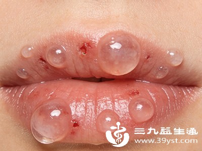 自身免疫性疾病