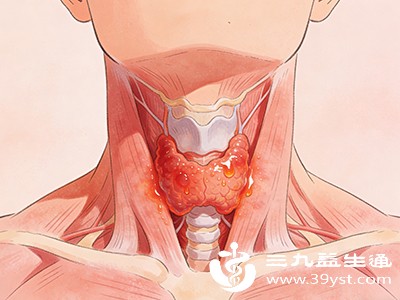 淋巴结治疗方法大盘点不同病症对应不同方案