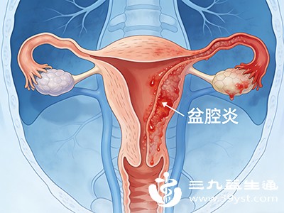 感染风险显著升高 感染风险显著升高