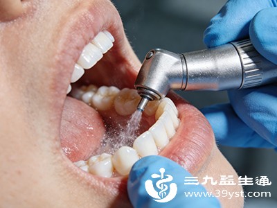 超声波洁牙