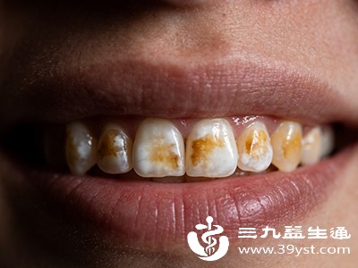 四环素牙及遗传性变色牙的治疗