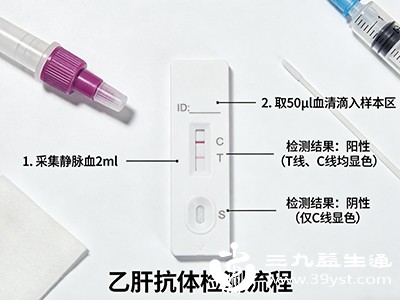 定期复查抗体水平