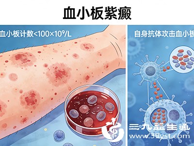 某些全身性疾病如血小板减少性紫癜、白血病、弥散性血管内凝血等，会影响凝血功能，导致消化道出血，进而引起大便黑色