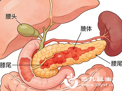 多在食用高脂高蛋白食物，如动物内脏、油炸食品等之后4-6小时发作，一次性饮用50克以上的白酒也容易诱发胰腺疼痛