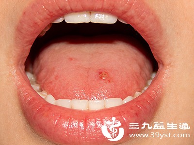 为啥上颚会肿痛 损伤感染还是上火 对症施策才能好得快