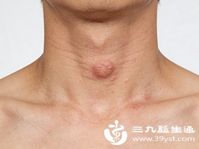 喉结旁有肿硬块 从炎症到肿瘤可能的原因与就医指南