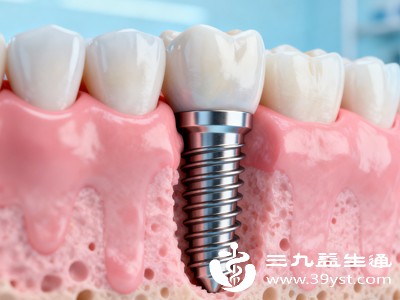 种植牙的仿真度极高，牙冠材质接近天然牙齿，颜值与功能兼具，能完美恢复咀嚼功能和发音，咀嚼效率堪比天然牙