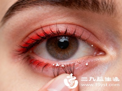 过敏性结膜炎是眼结膜接触过敏原后引发的炎症，和过敏性鼻炎同属过敏性疾病，常同时发生，但发病部位在眼部