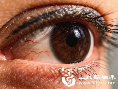 睑缘炎是眼睑边缘(眼皮边缘)的慢性炎症,成因主要与油脂分泌异常、细菌滋生有关,长期熬夜、过度用眼、使用劣质化妆品、营养不良等 睑缘炎是眼睑边缘(眼皮边缘)的慢性炎症,成因主要与油脂分泌异常、细菌滋生有关,长期熬夜、过度用眼、使用劣质化妆品、营养不良等