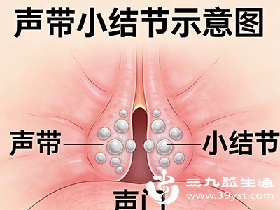 药物缓解炎症 药物缓解炎症