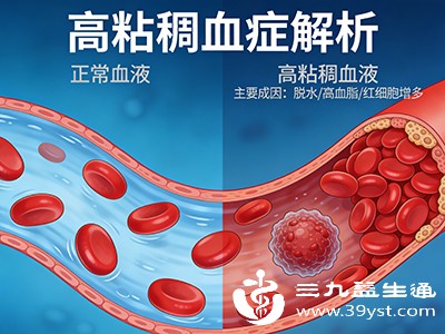 血液黏稠别忽视 饮食调理+运动改善方法全掌握