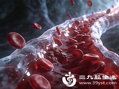 血液黏稠别忽视 饮食调理+运动改善方法全掌握