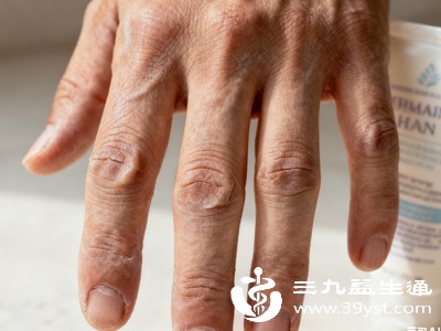 上班族必看 打字多导致指关节粗大 简单拉伸+习惯调整 低成本拯救双手