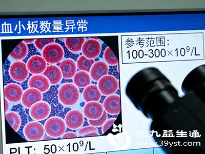 若同时出现红细胞计数下降、白细胞异常，可能提示造血系统整体存在问题，如骨髓增生异常综合征等，需及时就医