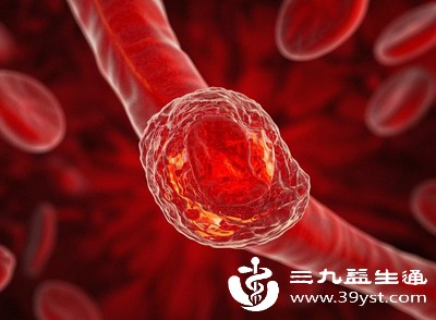 动脉硬化、血栓等会导致手部血管狭窄或堵塞，血流不畅，出现持续性麻木，常伴有手部发凉、颜色改变，高龄或高血压人群需特别注意