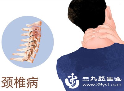 颈椎病压迫神经