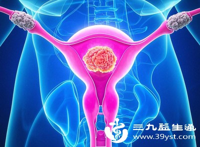 子宫肌瘤、子宫内膜异位症患者需在医生严密监测下使用，避免刺激病灶增长