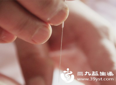 关注针灸安全 4种易忽视的不良反应 从成因到应对一步到位