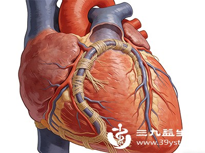 多数心肌桥患者终身无明显症状，仅在体检或其他心脏检查时偶然发现