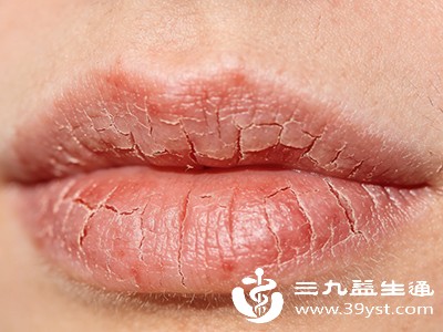 嘴唇又白又干可能是缺水 缺营养 还有这些疾病在“提醒”你