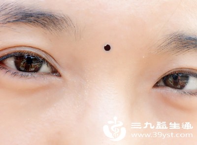 速看 脖子长痣的医学真相 从形成到护理 全面了解不踩坑