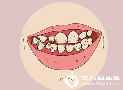 吃苹果 刷牙都出血 牙龈在“报警” 这些局部和全身因素得一一排查