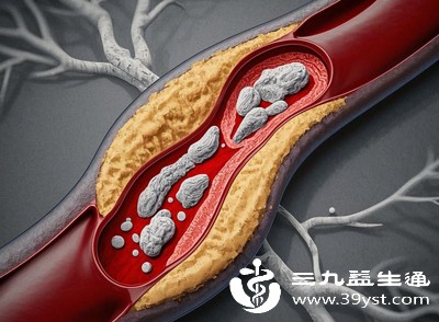 动脉硬化、血栓等疾病会影响血液流动，导致手部供血不足