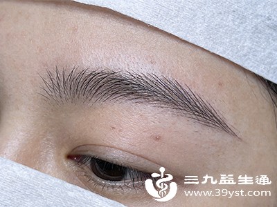 自体毛囊移植 自体毛囊移植