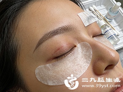 7天拆线后的护理