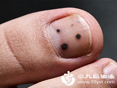 临床表现 临床表现