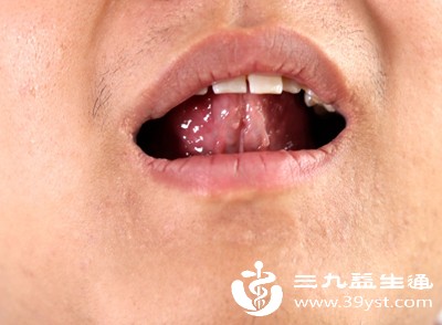 真菌感染 真菌感染