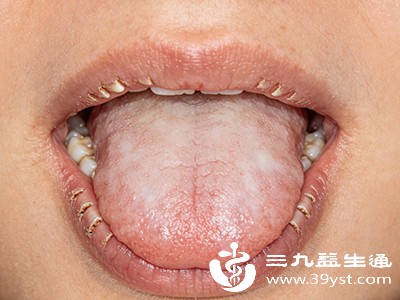 舌部疾病 舌部疾病