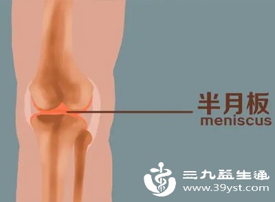 半月板损伤 半月板损伤