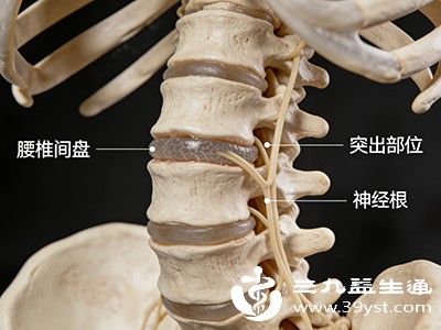 脚趾头发麻别忽视 不一定是缺钙 这几个常见诱因要先排查清楚