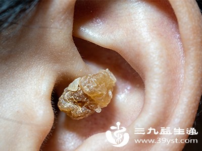 耳结石形成的“幕后推手”找到了 频繁戴耳机上榜 教你预防