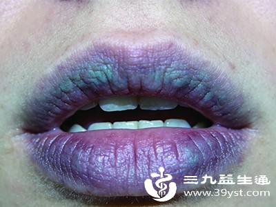 嘴唇紫绀