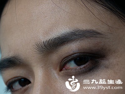 眼周发黑水肿