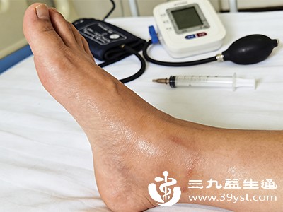 区分生理性与病理性水肿