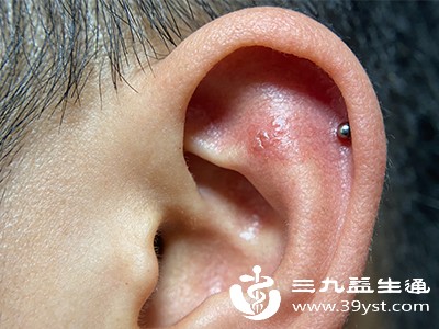 轻微红肿、瘙痒