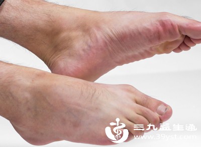 脚总臭别怨鞋 真正原因在这 早知道早改善