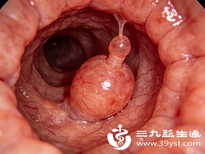 肠道疾病病史 肠道疾病病史