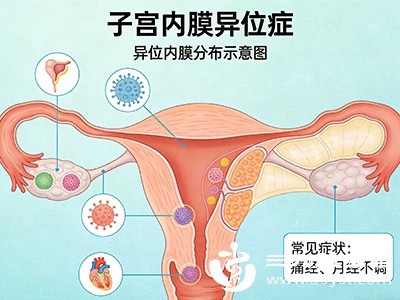 女性左下腹痛别忽视 可能是这些原因在“作祟” 早知道早关注