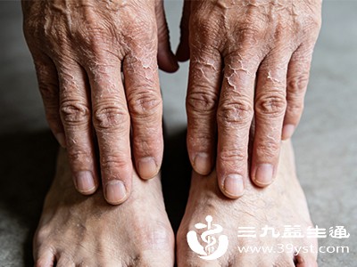 此时，手脚皮肤的水分会快速被干燥的空气夺走，若不及时补充水分和油脂，就会出现干燥症状