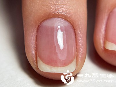 指甲掉了还能长出来吗 关于指甲再生的那些事