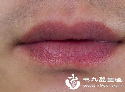 嘴唇长期发紫可能是心脏在“求救” 这几个伴随症状要记牢