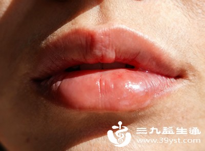 我们正常的嘴唇颜色是温润的淡红色