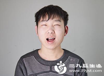 频繁做夸张的表情,如眯眼、大笑等,会让眼部皮肤产生细纹,长期下来可能导致皮肤松弛,形成眼袋 频繁做夸张的表情,如眯眼、大笑等,会让眼部皮肤产生细纹,长期下来可能导致皮肤松弛,形成眼袋