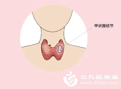 甲状腺功能异常