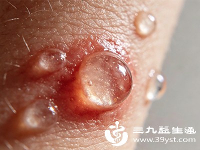 感染风险骤增 感染风险骤增